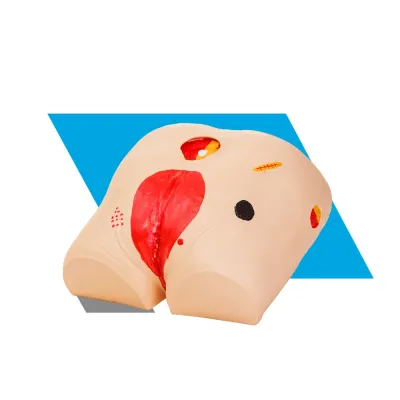 MODELO DE TRATAMENTO PARA ÚLCERA EM DECÚBITO